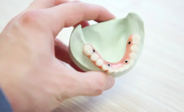 Higiene bucodental opiniones: ¿Es difícil ser higienista bucodental?