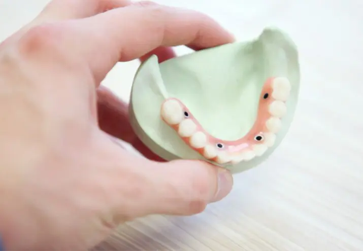 Higiene bucodental opiniones, Higiene bucodental opiniones: ¿Es difícil ser higienista bucodental?