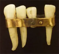 historia prótesis dental